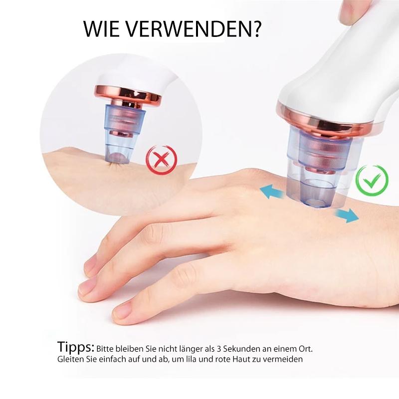 Mitesserentferner und Hautreiniger
